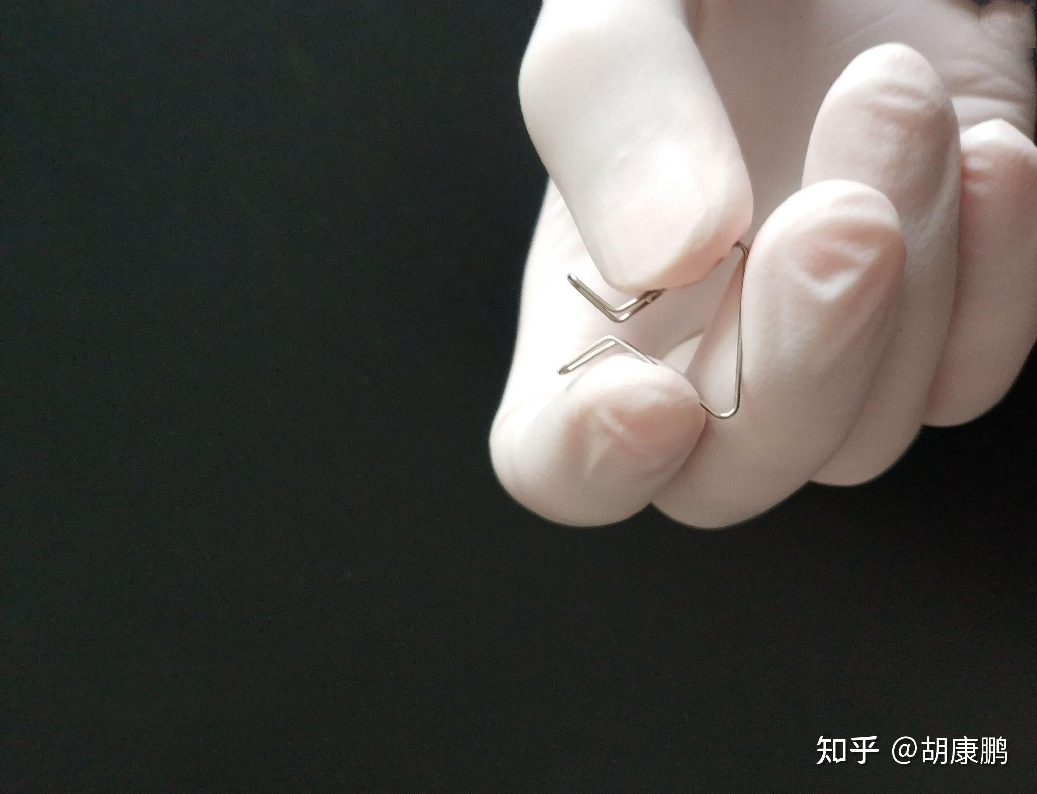 爱阔尔达包茎扩张器答疑