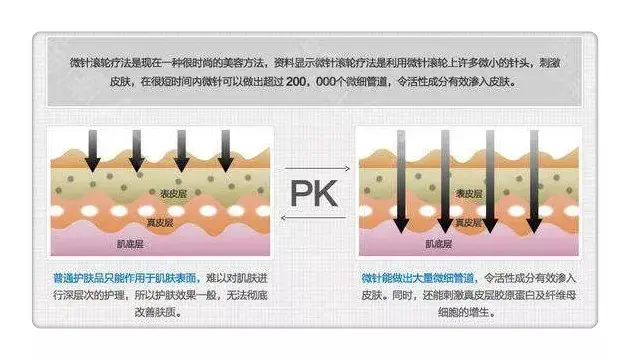 微針戰痘實力不容小覷