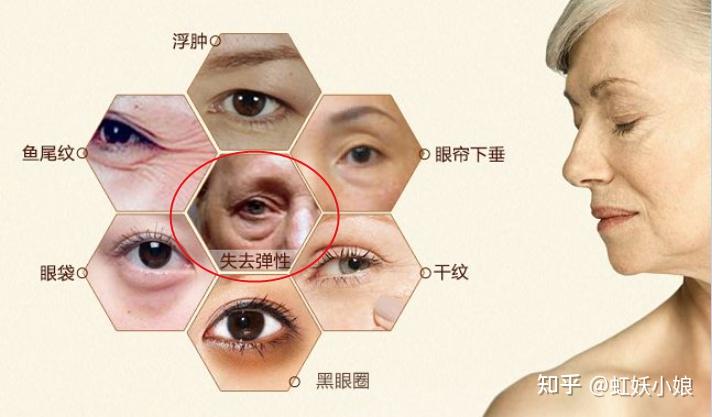眼部护理分享黑眼圈眼袋特别严重怎么办如何才能有效改善眼周问题眼霜