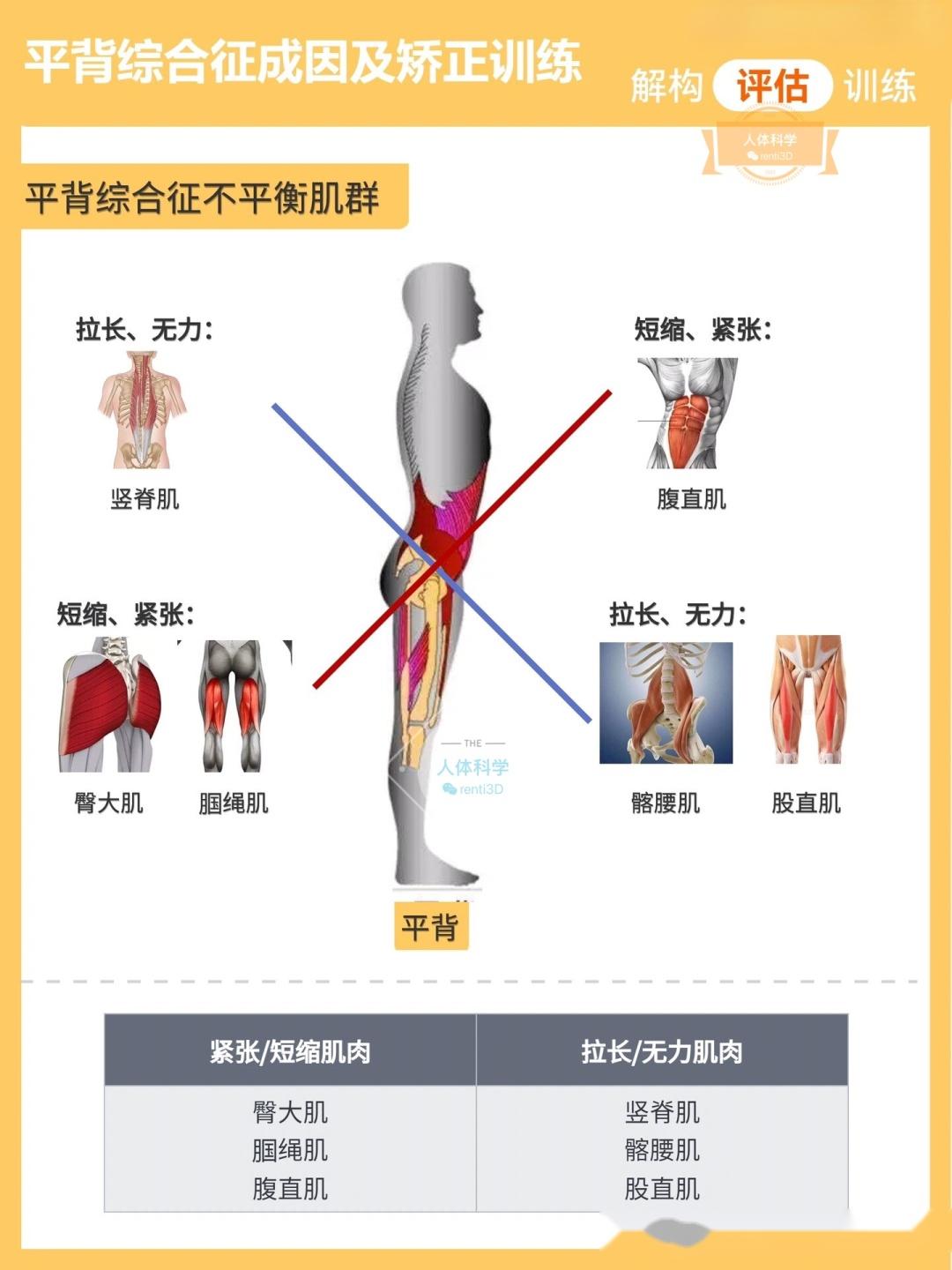 【平背体态】后背变直的成因及运动矫正思路 - 知乎
