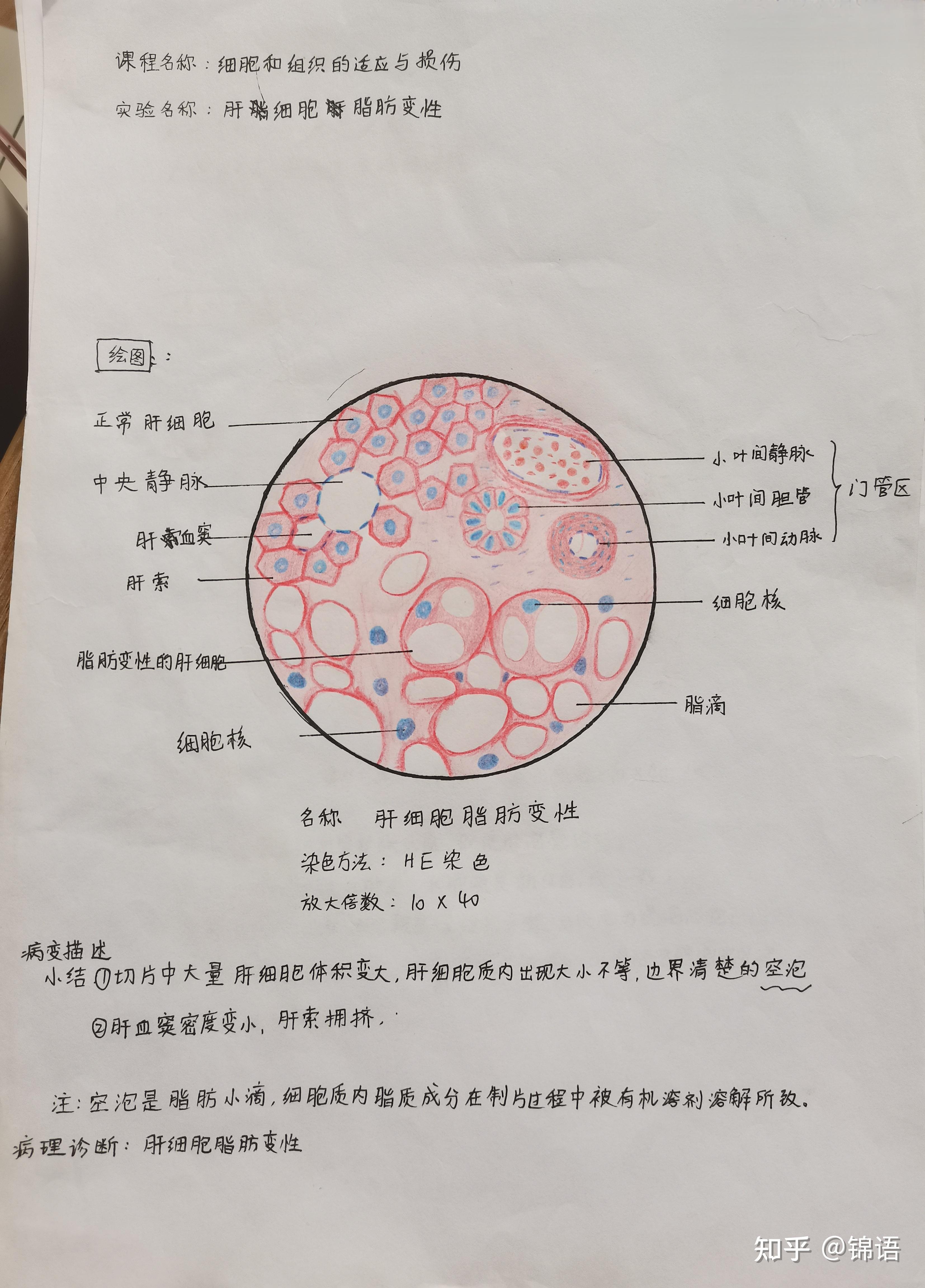 肝细胞红蓝铅笔图片