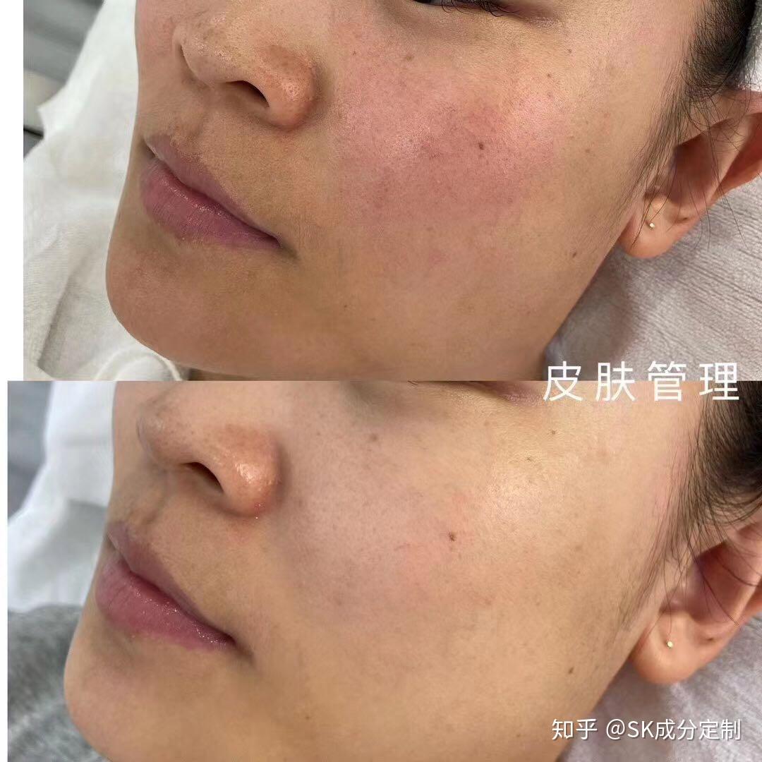 在家就能做皮肤管理为什么还有人去美容院呢