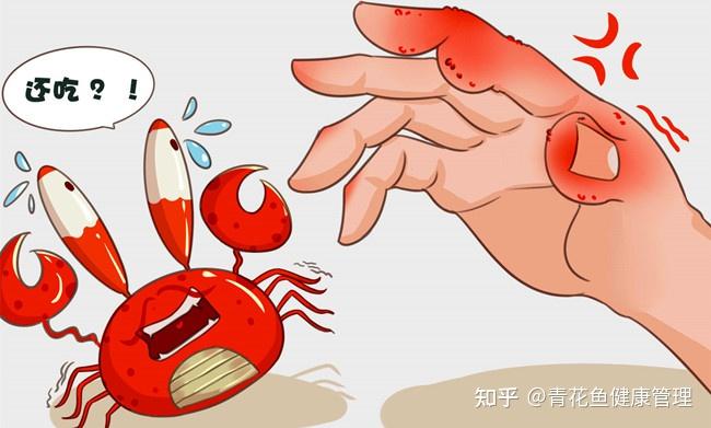 由于尿酸盐沉积在手指部位,析出结晶后会使手指关节肿胀,发红发烫