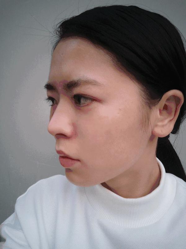 关晓彤张天爱的眼袋是因为中面部发育不良杨紫的法令纹也跟着躺枪了中