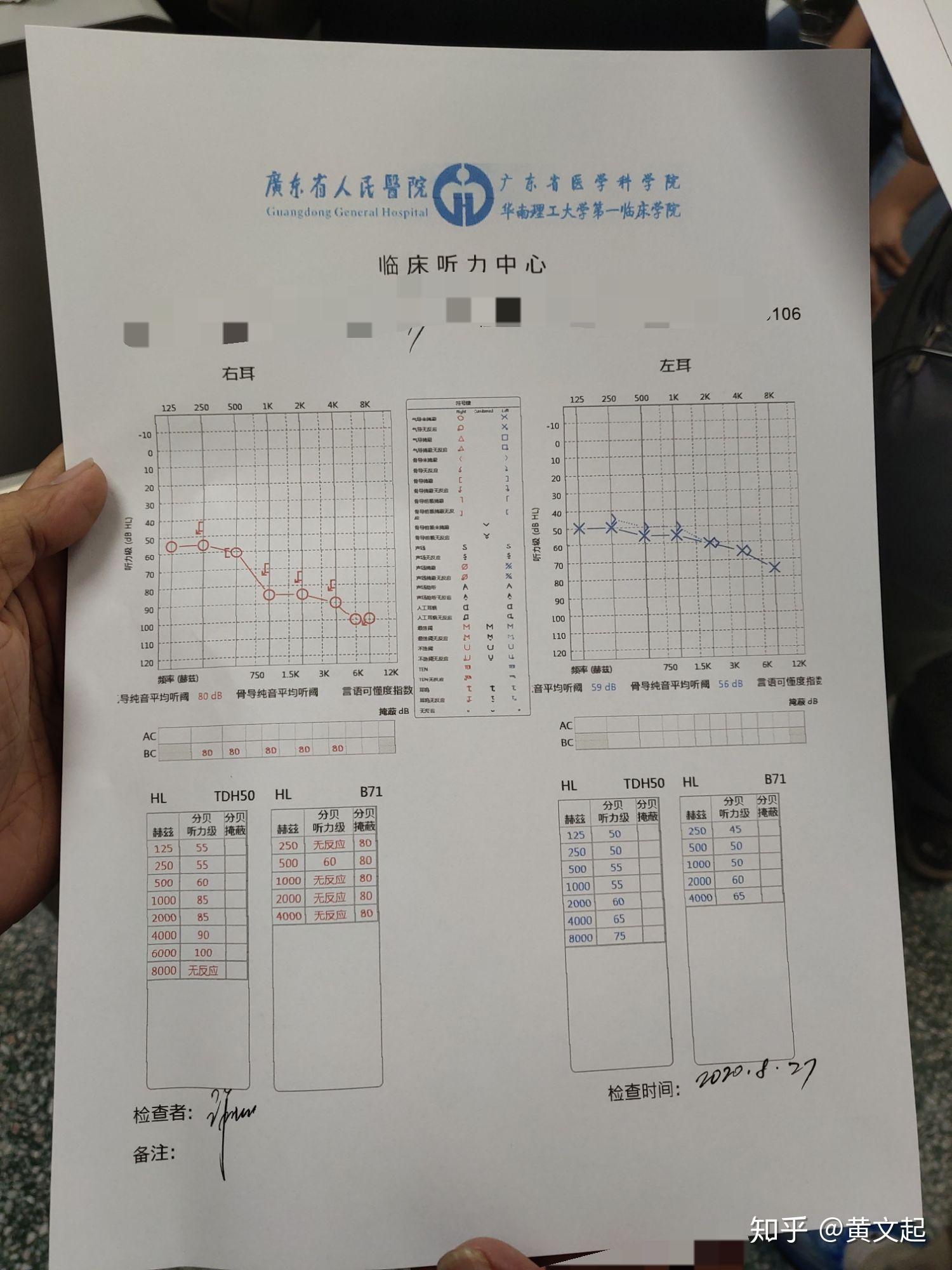 电测听正常图图片