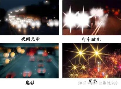 为什么近视手术会眩光？ - 知乎