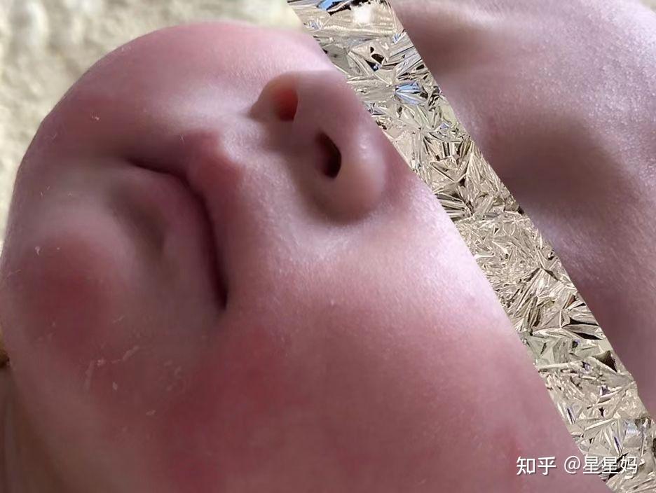 因为皮肤问题,变得红痒,皴裂,妈妈的心情难受的不行.