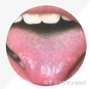 史上最全舌诊图谱!【珍藏版】 - 知乎
