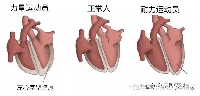 心输出量减少 zhuanlan.zhihu.com