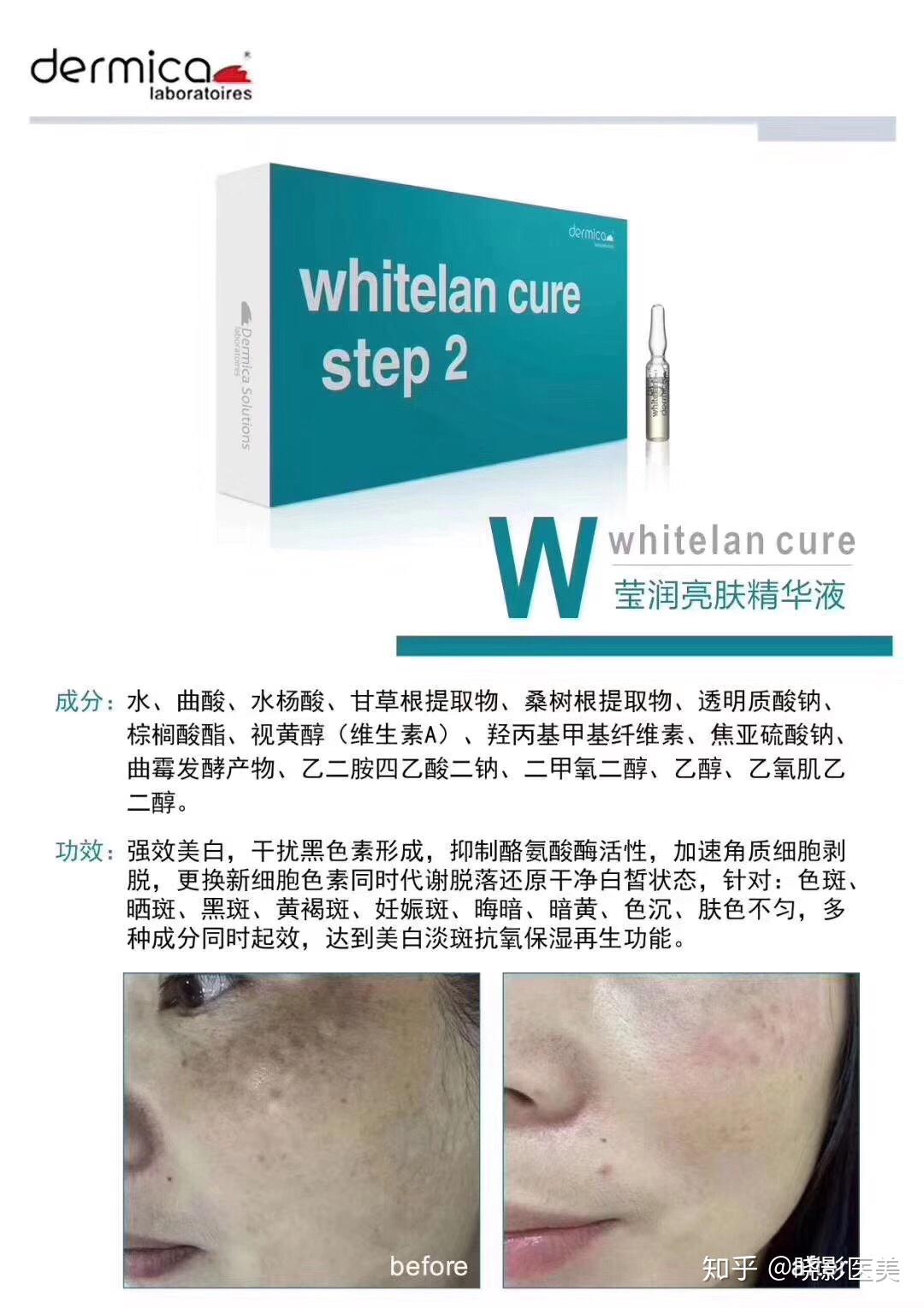 瑞士达美伽提升mts系列效果怎么样及产品搭配公式科普