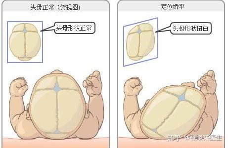 谈头部骨相审美（三）之枕骨 - 知乎