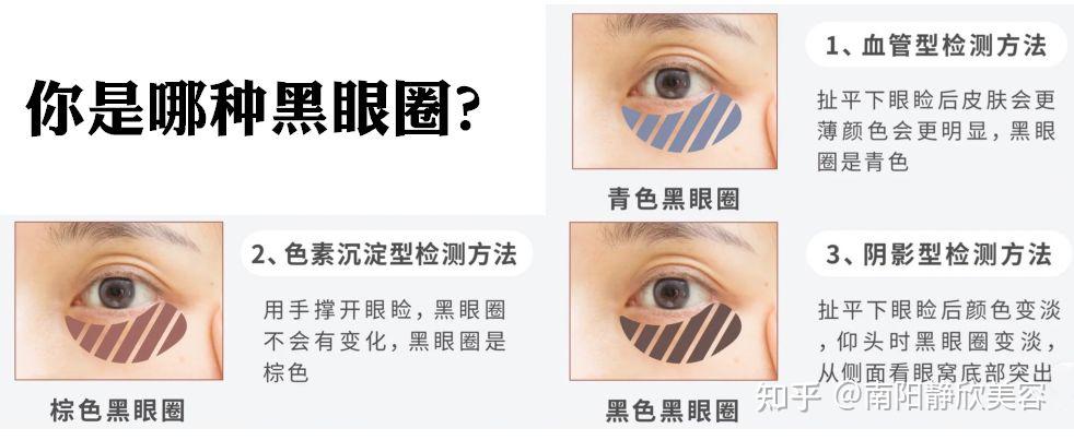 眼周衰老的几大特征快来get - 知乎