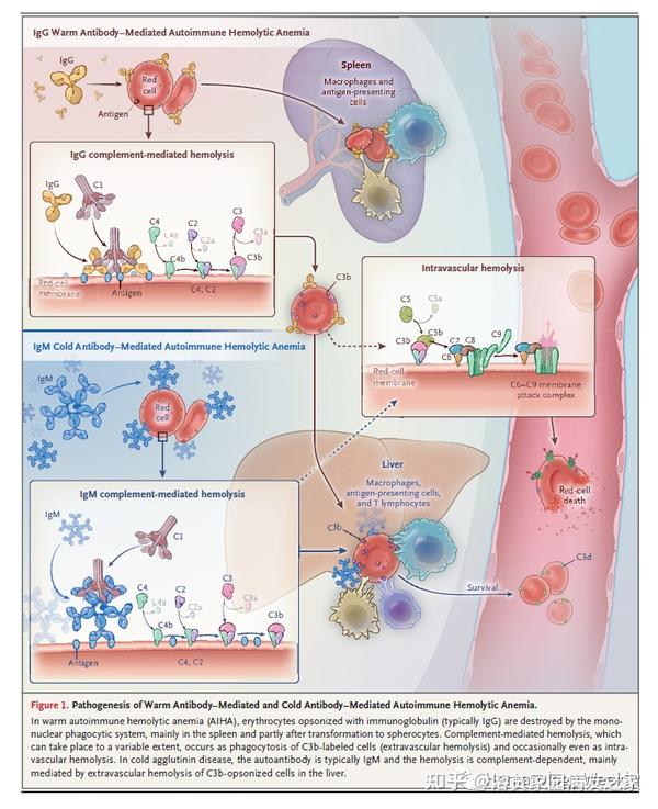 自身免疫性溶血性贫血,要点总结! 知乎 自身免疫性溶血性贫血,要点总结! 知乎