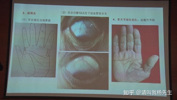 看的懂学的会,综合望诊(手诊+面诊+舌诊+目诊+耳诊) - 知乎