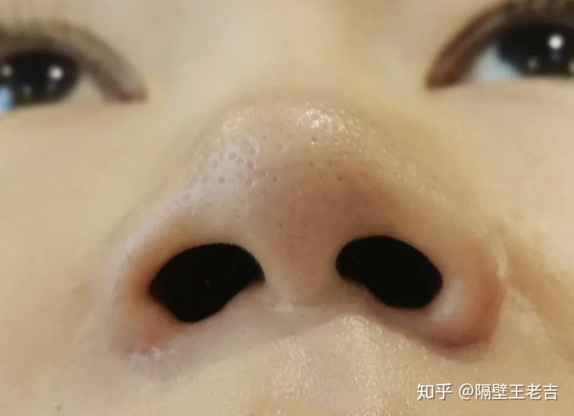 v2-565099b78ef4f0bbbf3426f76993358f_r.jpg