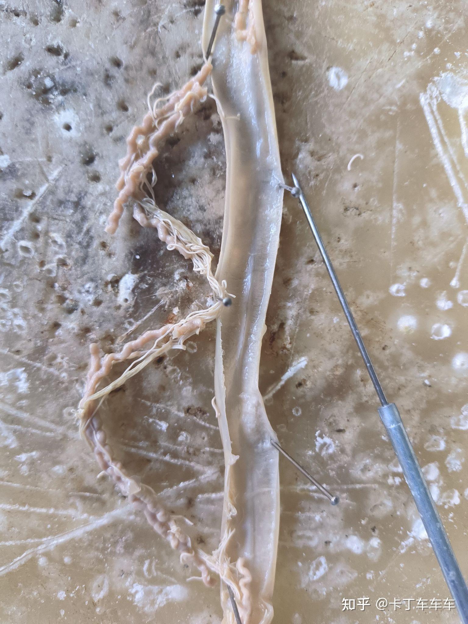 绘制雌雄蛔虫横切图. - 知乎