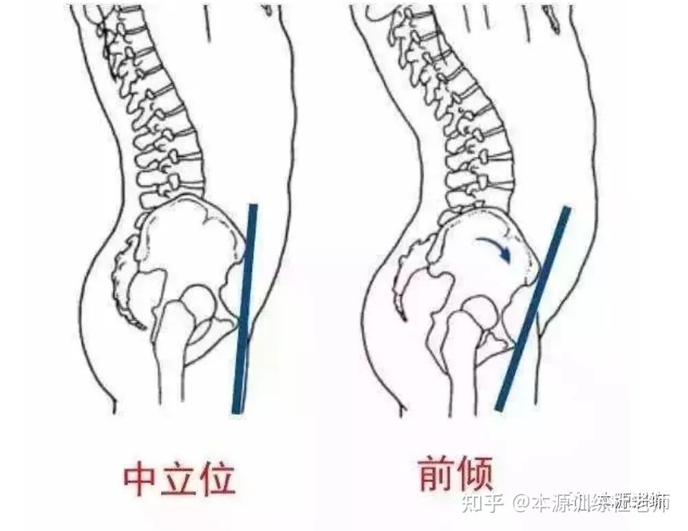 80的骨盆前倾都是骶骨上翘教你一招练出好骨盆