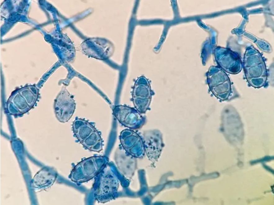 脚气真菌图片显微镜图片