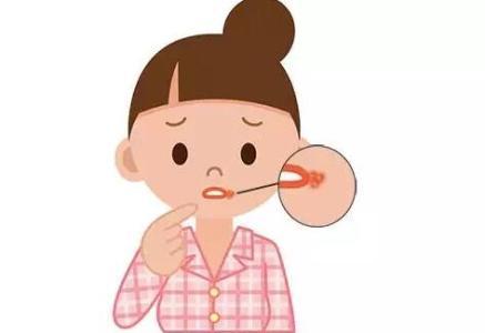 北京嘉禾妇儿医院:宝宝口角炎形成原因有哪些