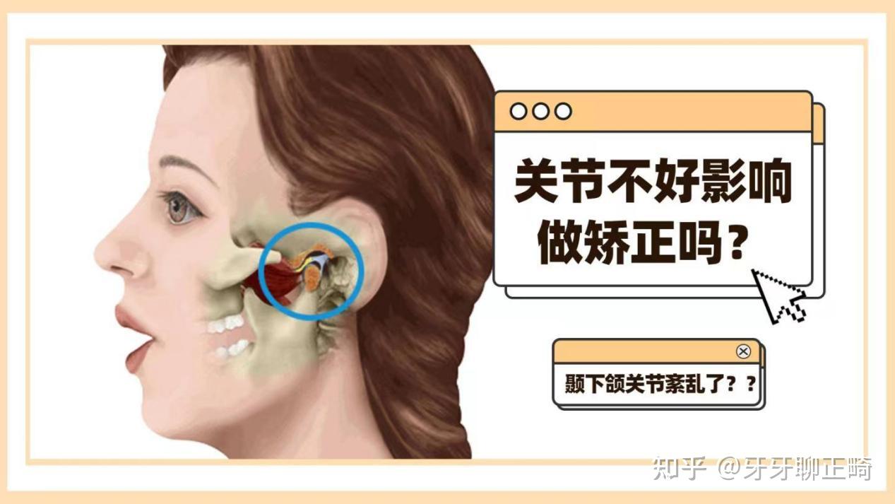 地包天怎么办?要正畸还是正颌? - 知乎