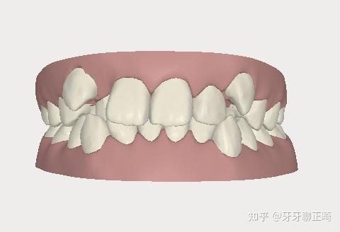 虎牙生长过程图片图片