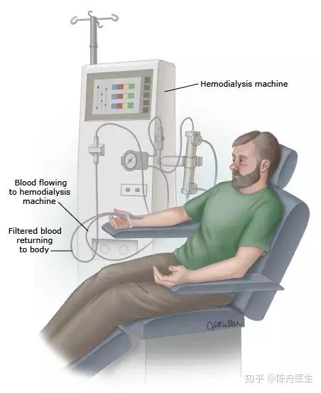 带您认识 血液透析 知乎