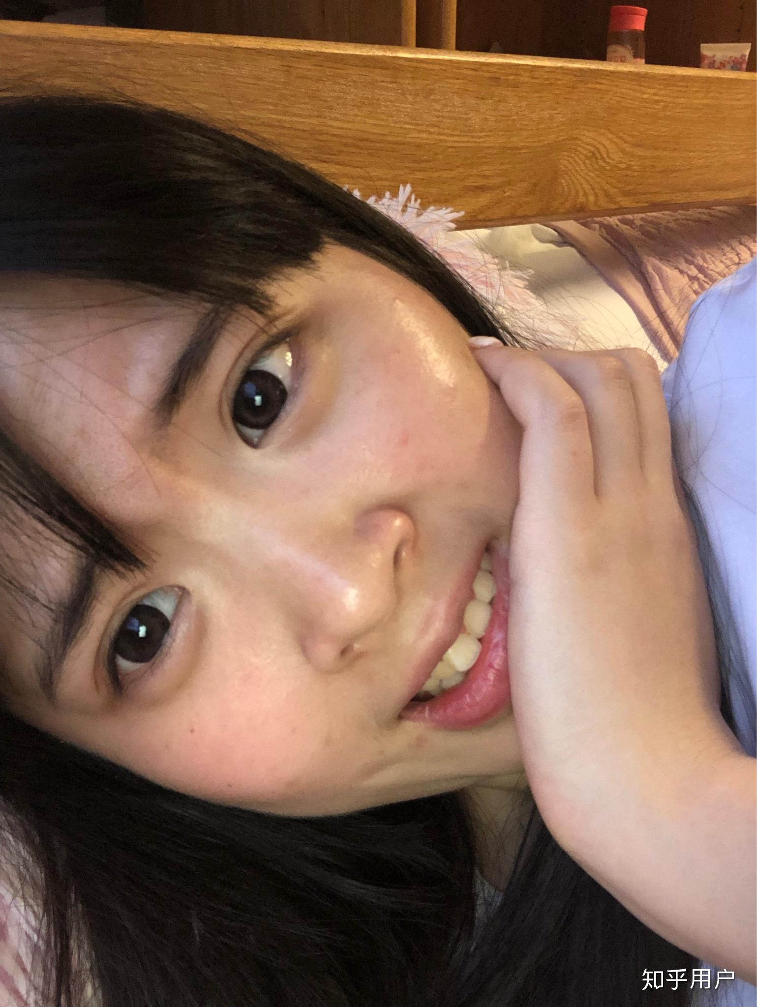 为什么有人的内眼角是圆的? - 知乎