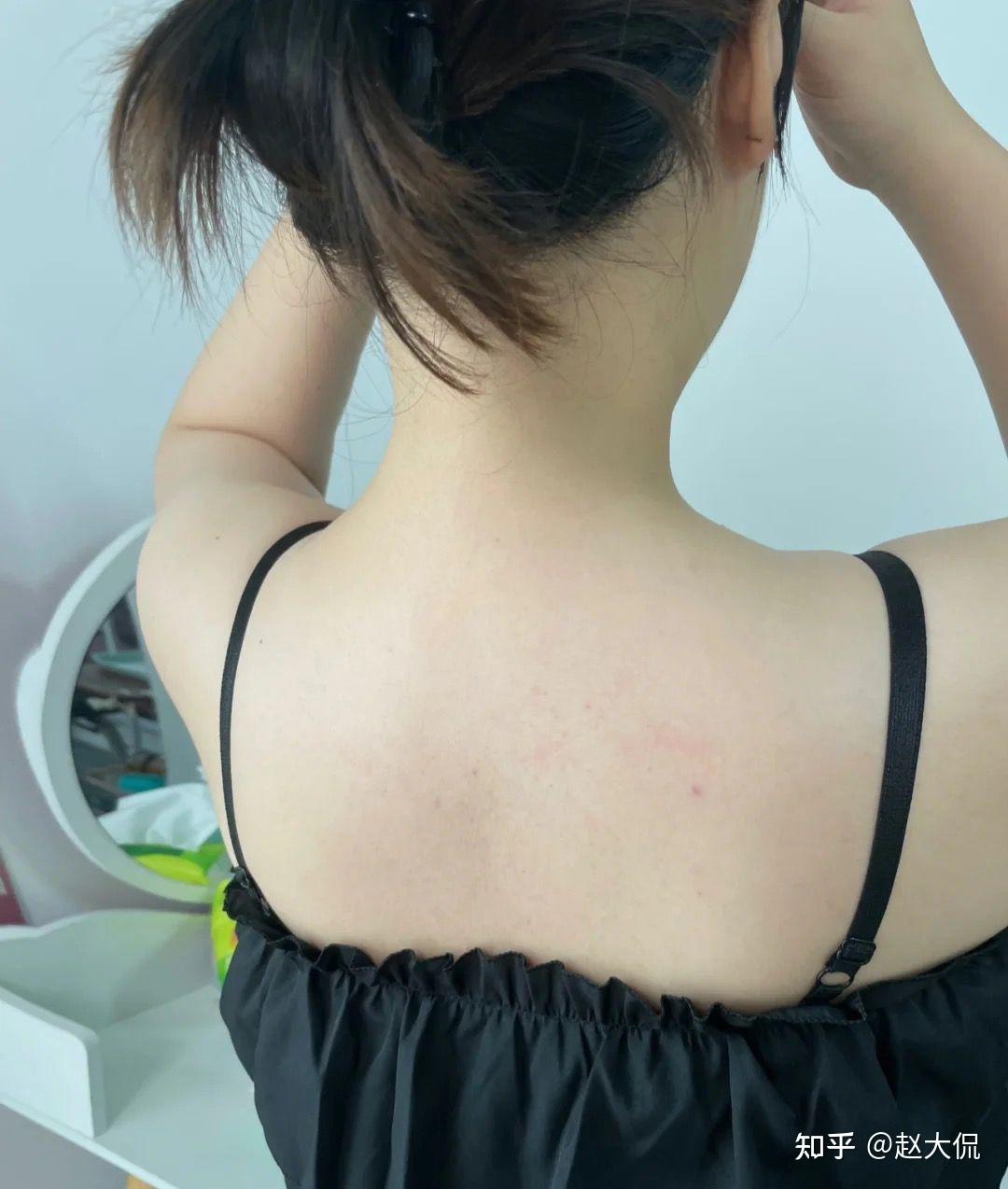 有没有人关注过腋下美白