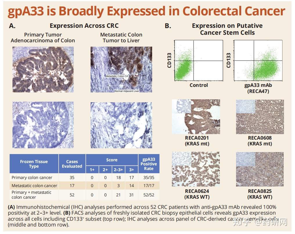 结直肠癌高潜力靶点：GPA33 - 知乎