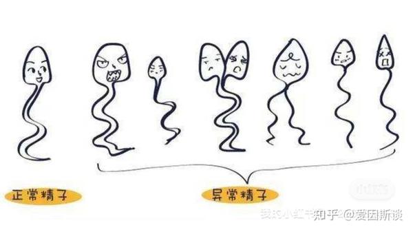 精子畸形率高是怎么回事 知乎