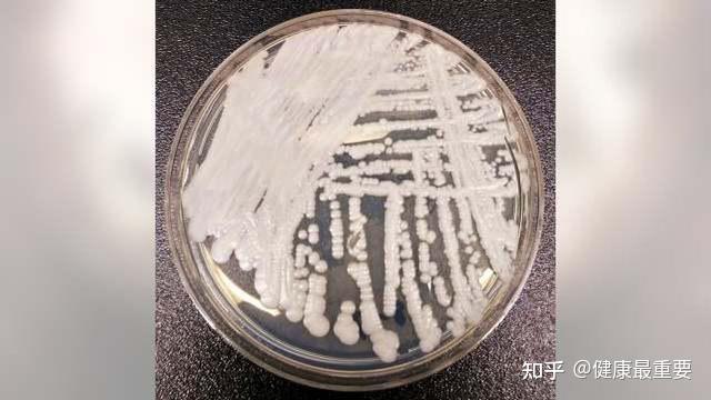 美国又现超级真菌超百人感染3人死亡