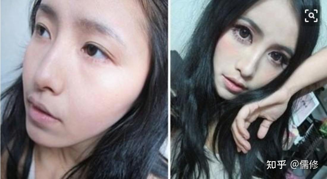 眼睛不好看?来来无痛切割/埋线技术了解下;鼻子不挺怎么办?