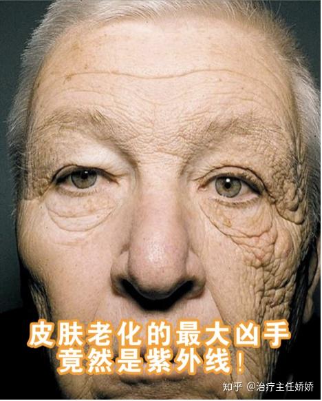 大家是不是也有疑惑,阳光还能把皮肤晒老化了.