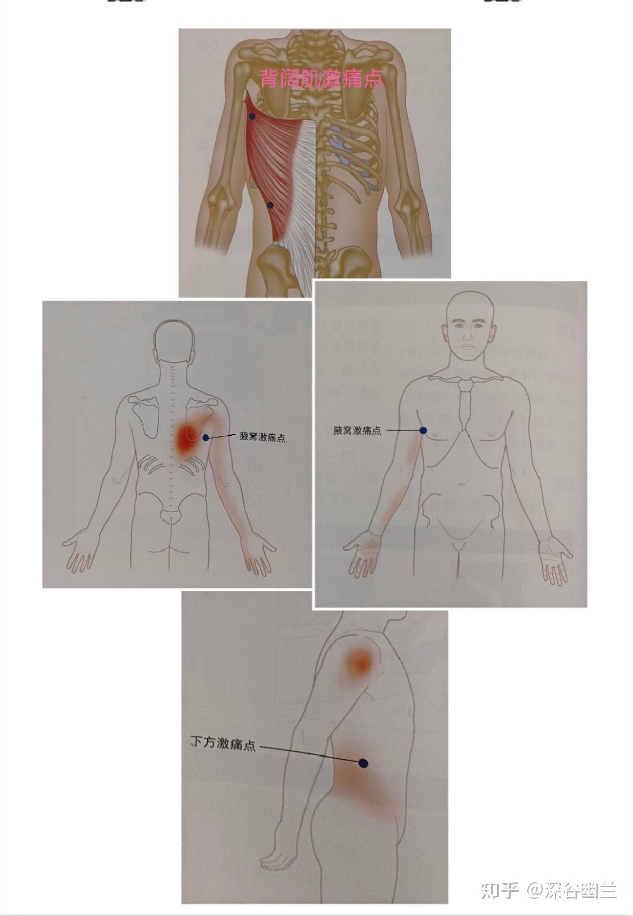 中背部疼痛相关激痛点及穴位