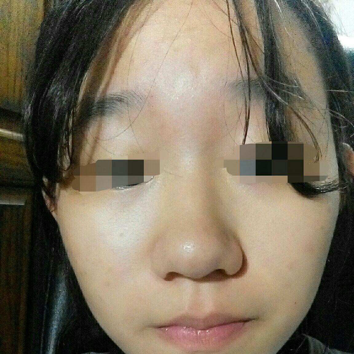 请问我的鼻子该怎么整? - 整容