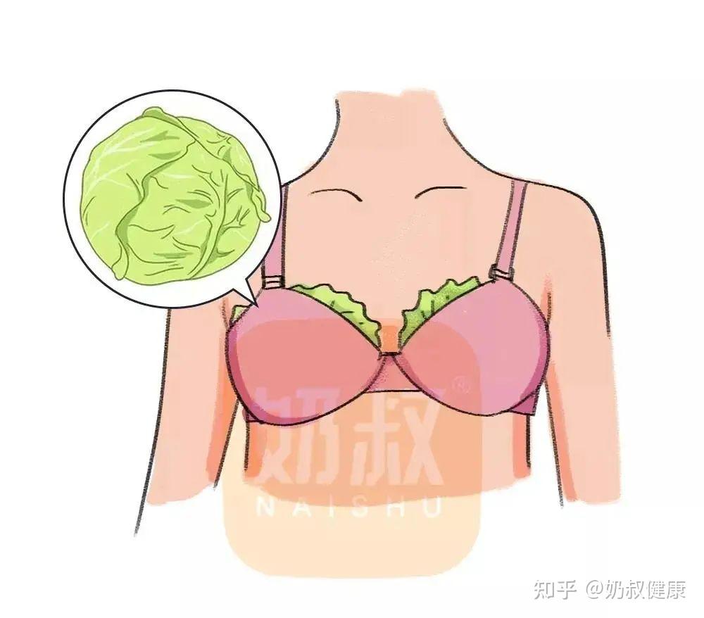 可以通過讓寶寶頻繁吸吮通乳,專業指導師乳腺疏通的方法