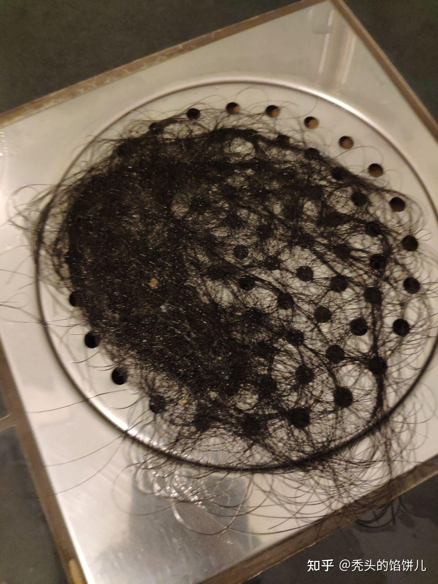 一个女生斑秃到全秃记录过程1无广告多图