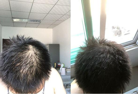 生发的最好方法 简单有效六个偏方 - 知乎