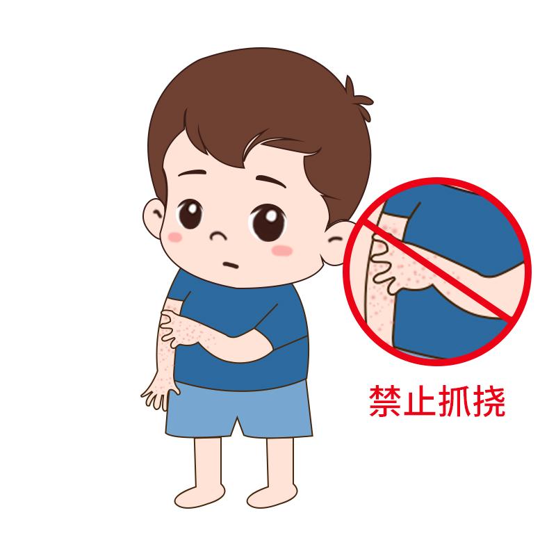 孩子难免抓挠,如果损伤皮肤,还有引起继发感染的危险.