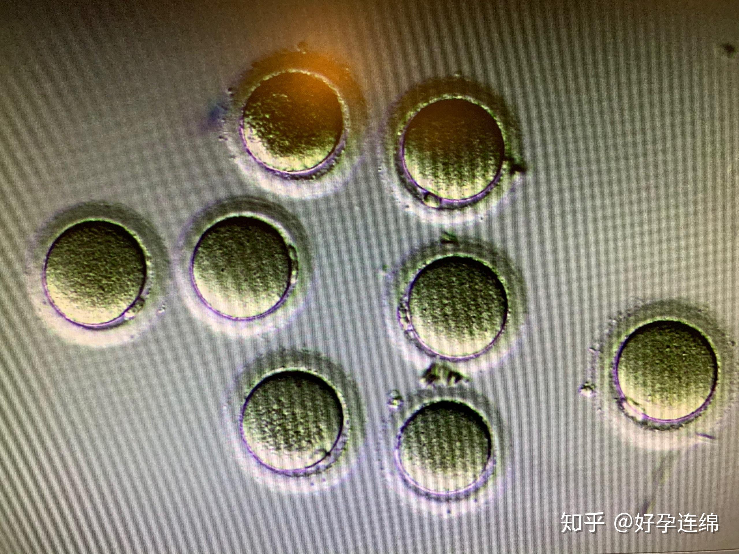 想冻卵或试管怎么获取冻卵资讯