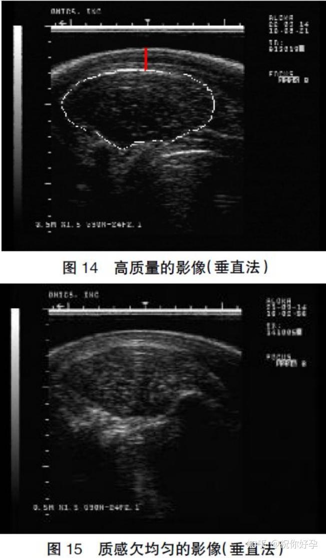 猪活体背膘厚、眼肌面积(B超)测定方法的研究 - 知乎