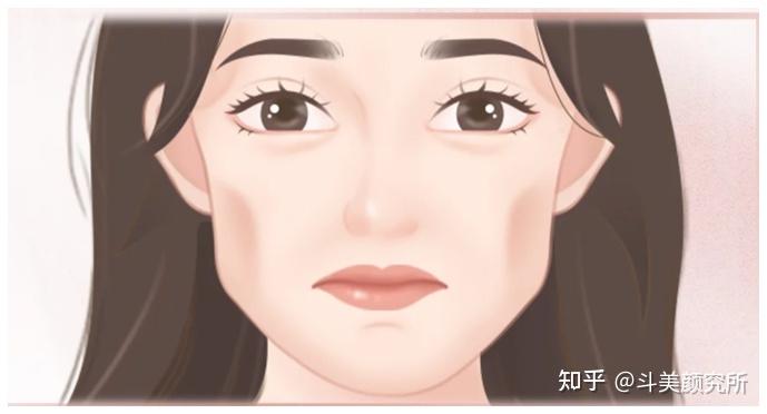 面颊凹陷的原因是什么？如何才能有效改善 - 知乎