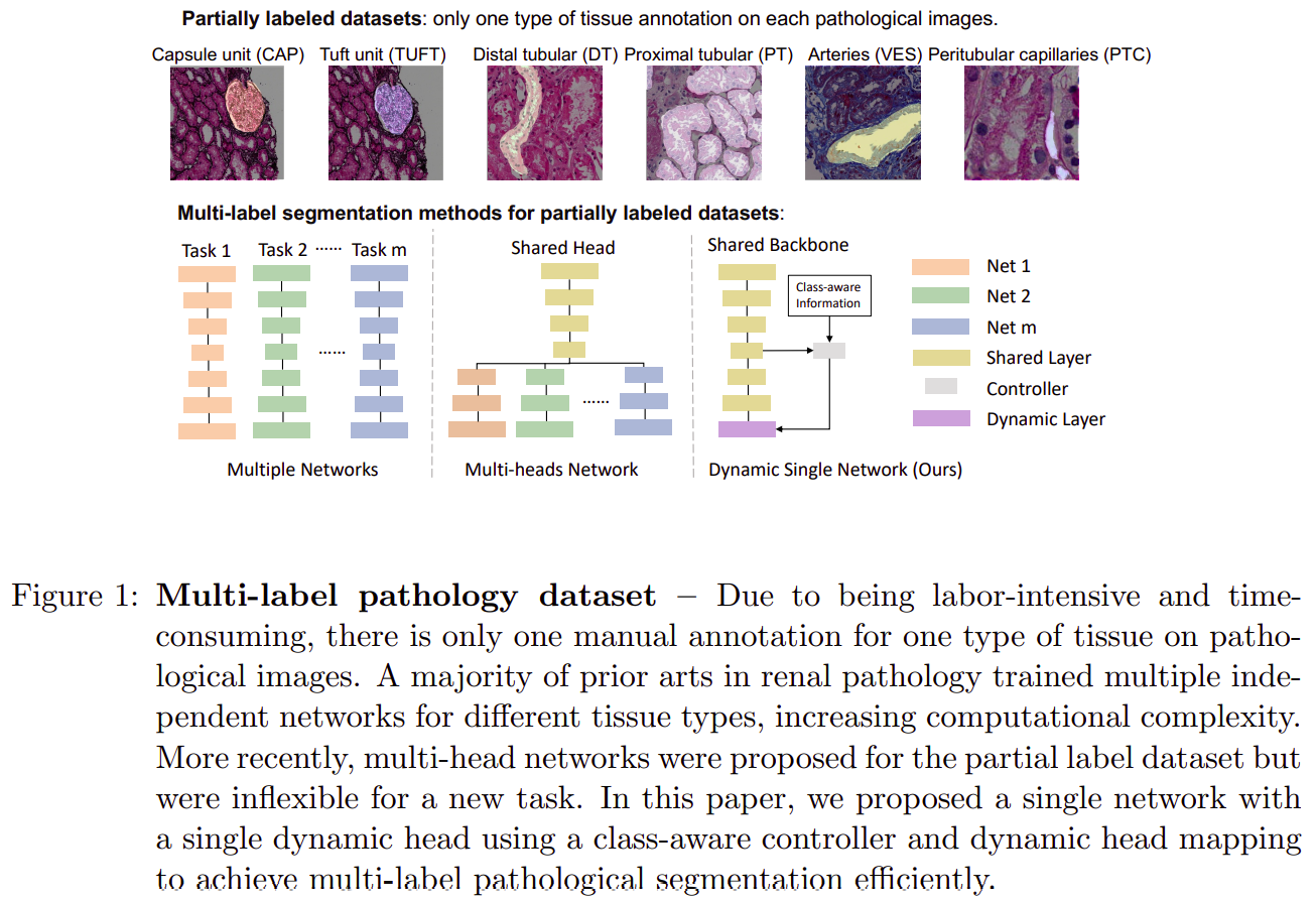 【arXiv:2112】Omni-Seg：使用部分标记数据进行多标签肾脏病理图像分割的单一动态网络 - 知乎