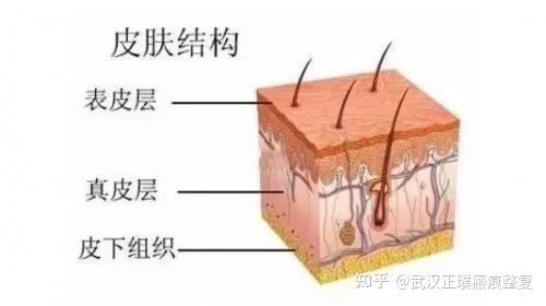 当皮肤出现伤口时,身体就会开始自动愈合,人体修复伤