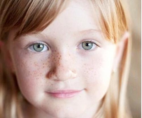 涂涂护肤老师 孩子脸上长雀斑 应该怎么办 知乎