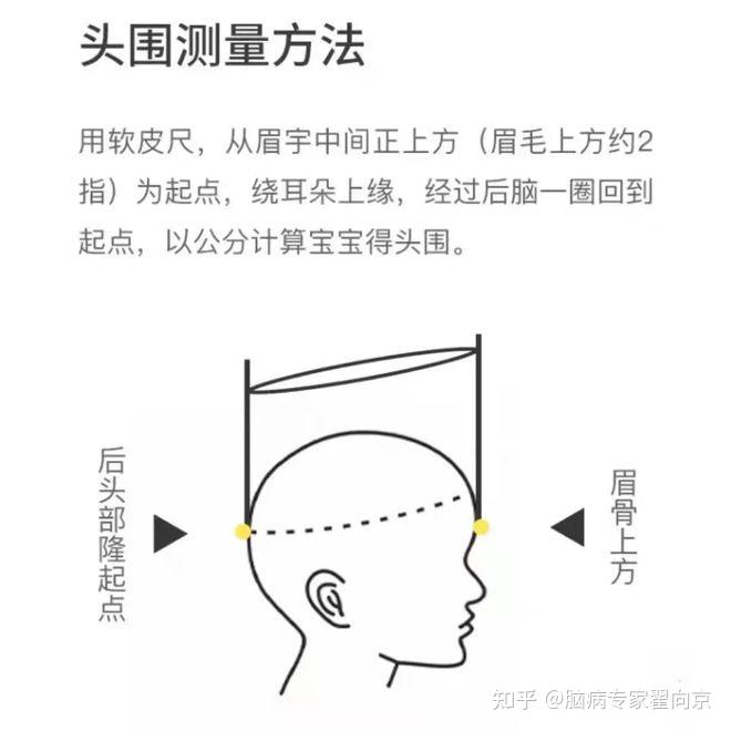 脑病专家翟向京：头围大或增长快的孩子肯定聪明？ - 知乎