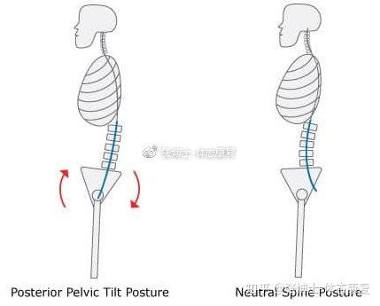 体态矫正 骨盆后倾的形成原因与矫正训练 知乎