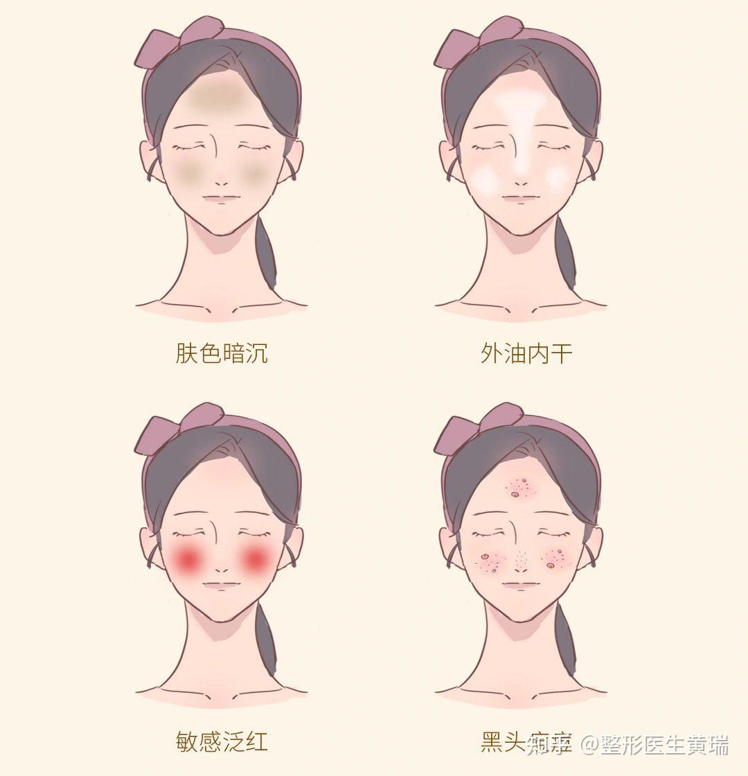 皮肤科普丨千万别小瞧皮肤炎症 - 知乎