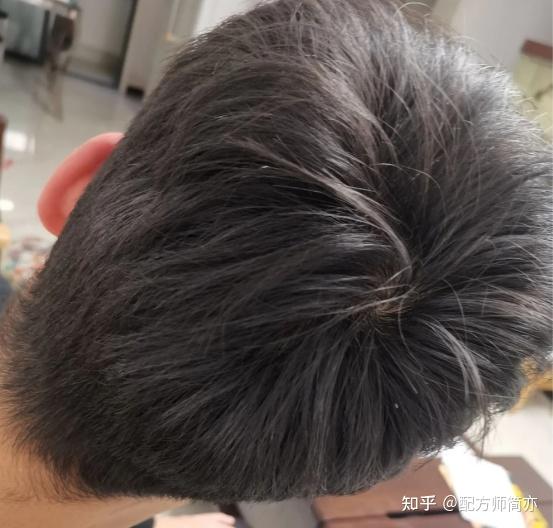 啥也不说了,我爱实验,实验爱我~就我那光明顶的