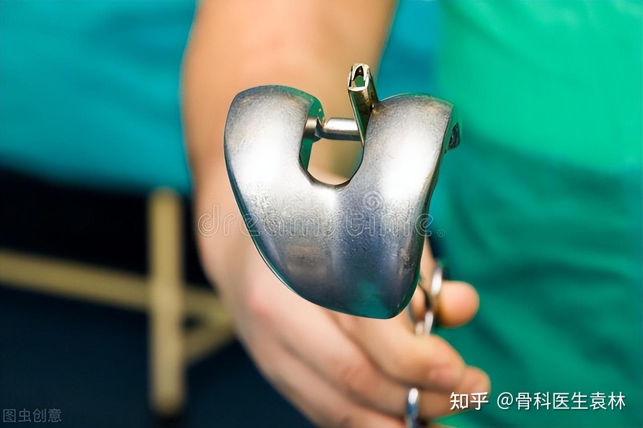 人工膝关节能够用多久?